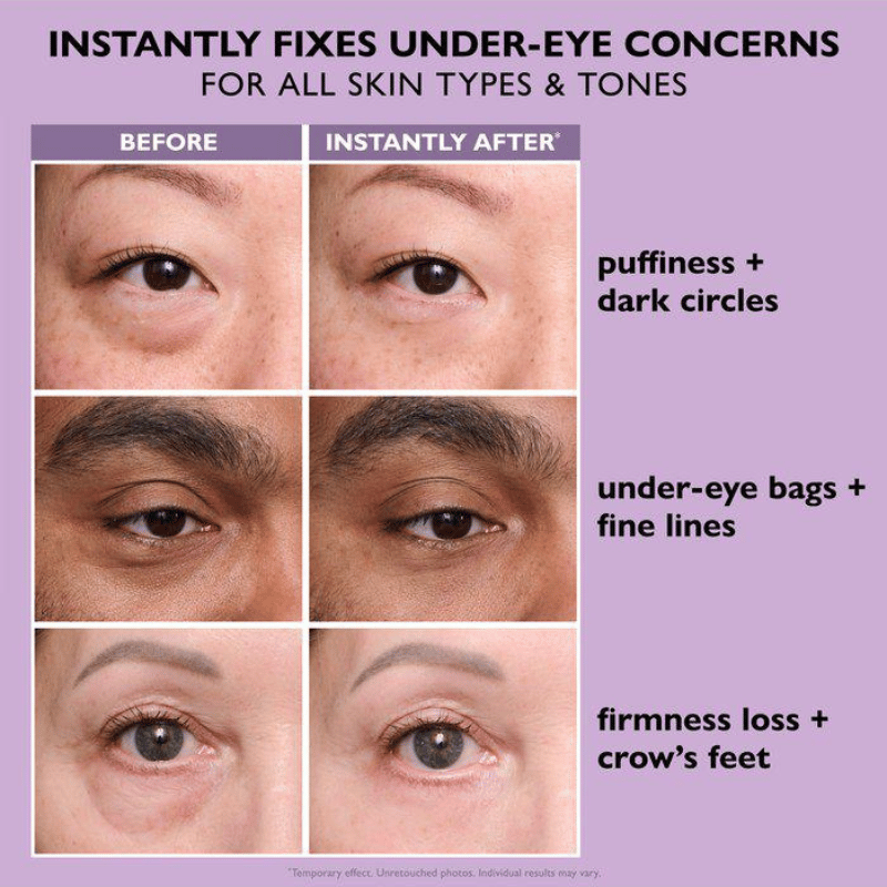 Peter Thomas Roth Instant FIRMx® Eye Temporary Eye Tightener Easy-Wear Inkl. Børste (20 ml)