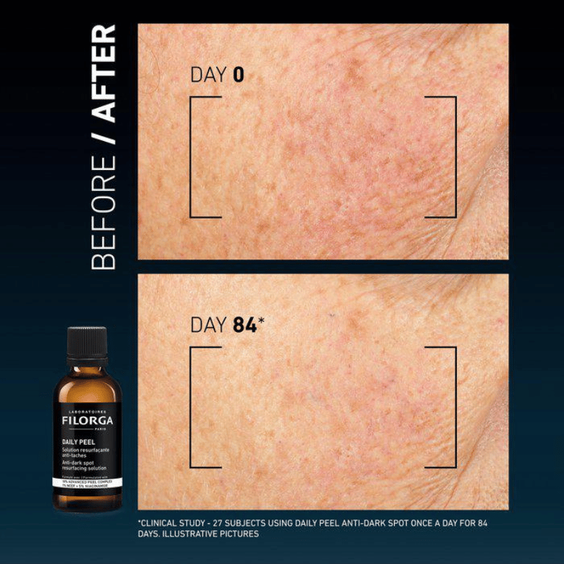 Filorga Clinical Home Peel Dark Spot (50 ml)