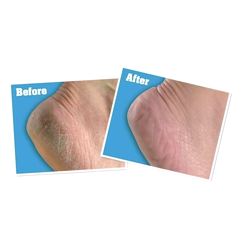 O'Keeffe's Healthy Feet Foot Cream (91 g)