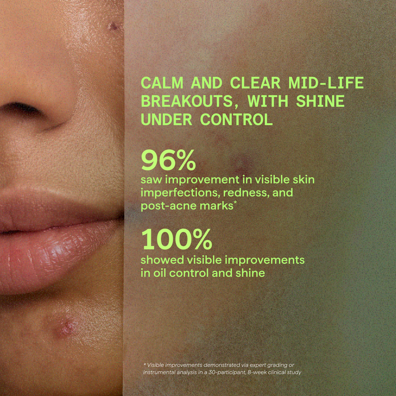 Murad Biome-Balancing Calm + Recover Cream (50 ml)